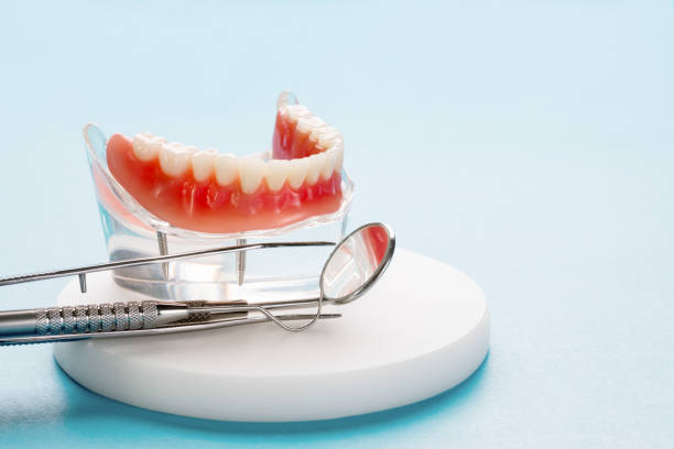 Best Wisdom Tooth Removal  in Keshore, LA